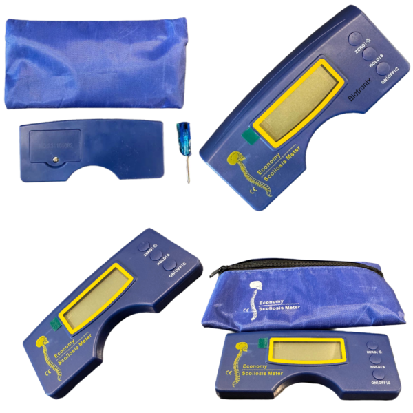 Accurate scoliosis angle measurement tool