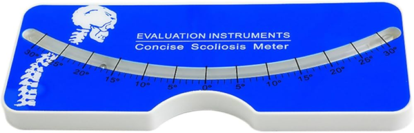 Scoliosis diagnosis tool
