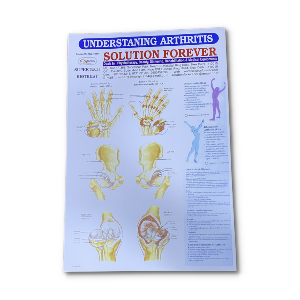 wall mounted physiotherapy charts